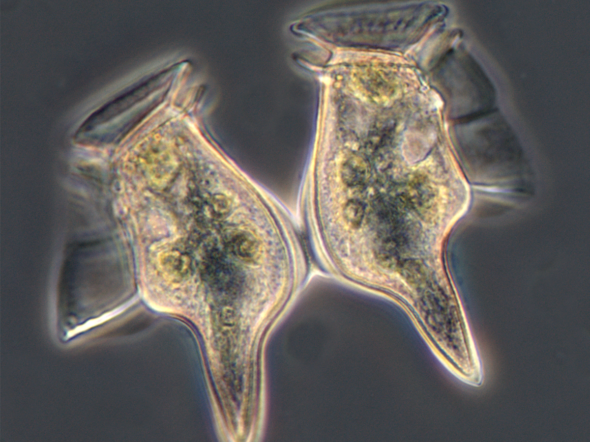 Dinoflagellates-Dinophysis caudata